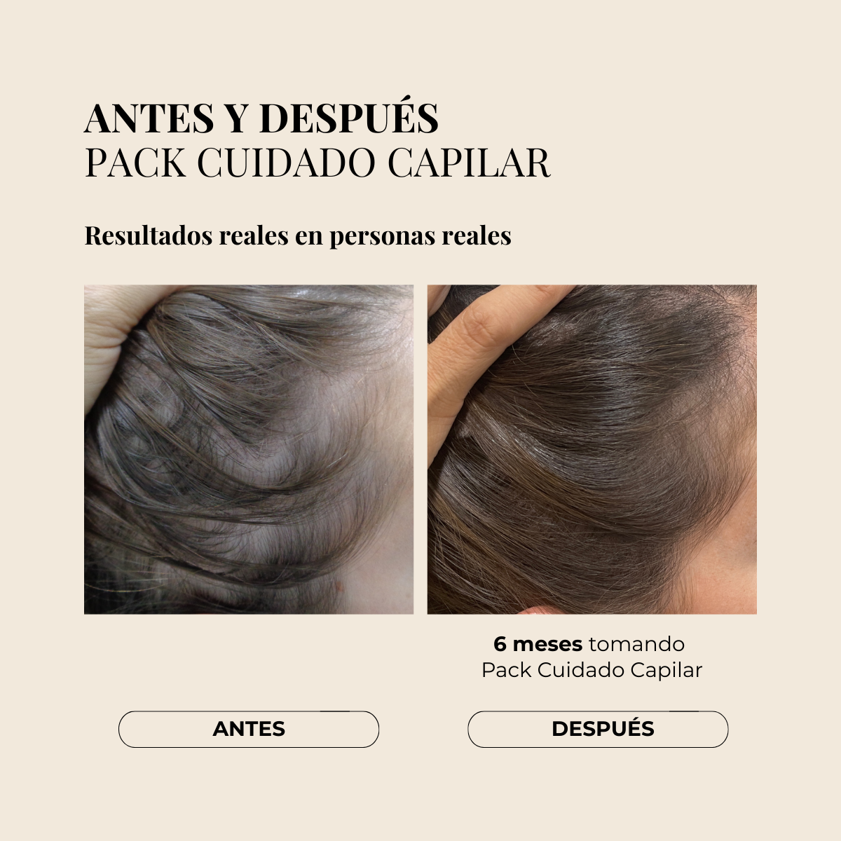 PACK CUIDADO CAPILAR