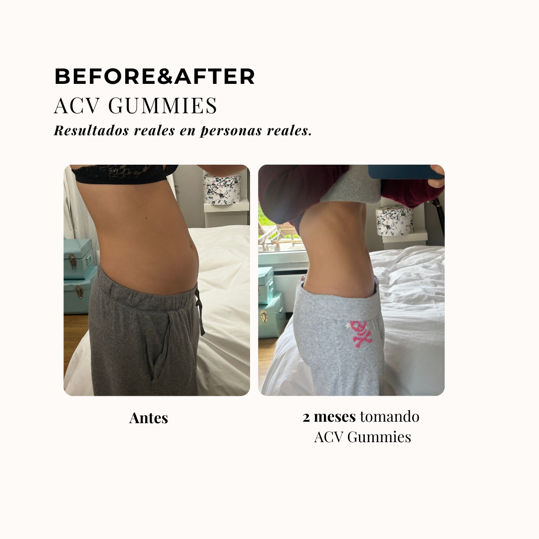 PACK VINAGRE DE MANAZA + GUMMIES SACIANTES