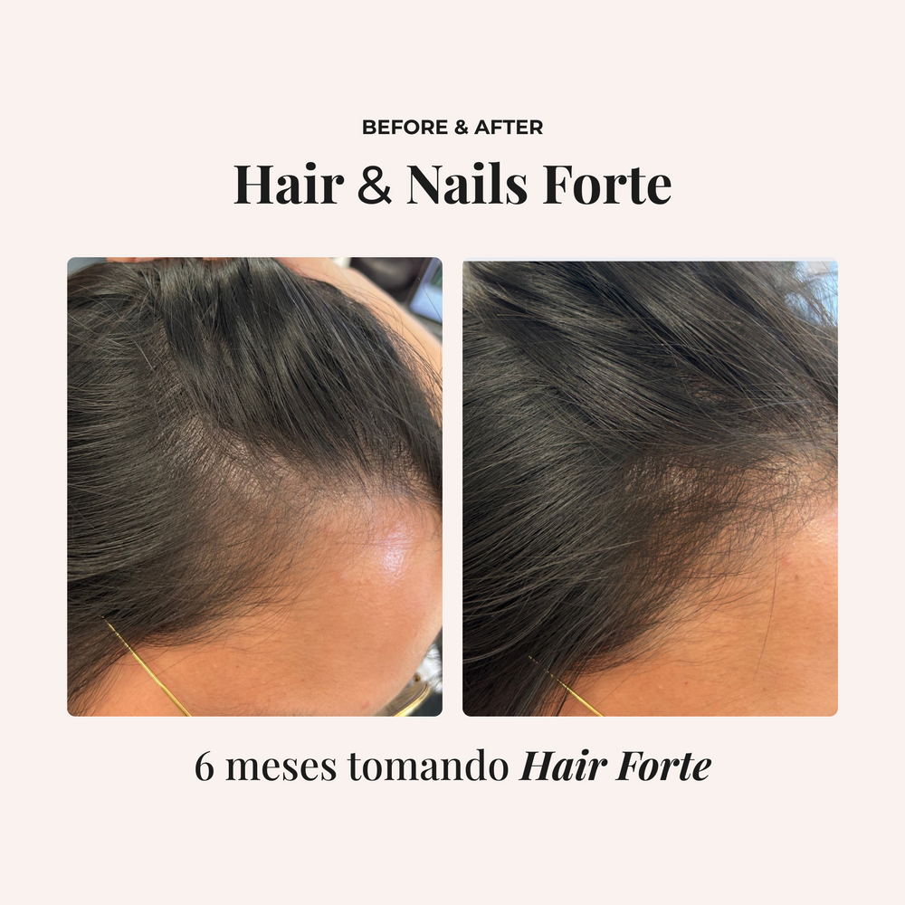 Comparativa antes y después de seis meses de uso