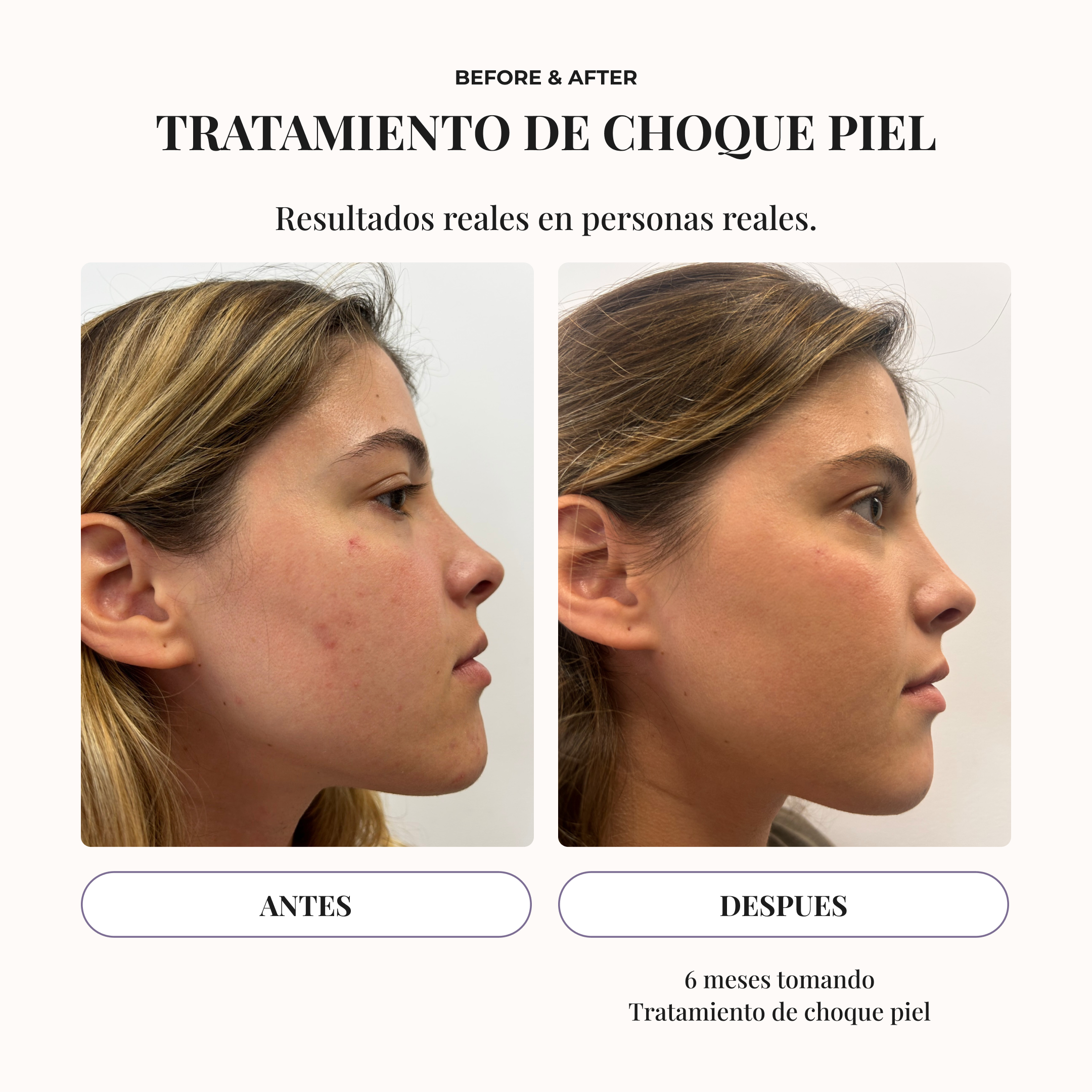 VIALES 360º SKIN FORMULA