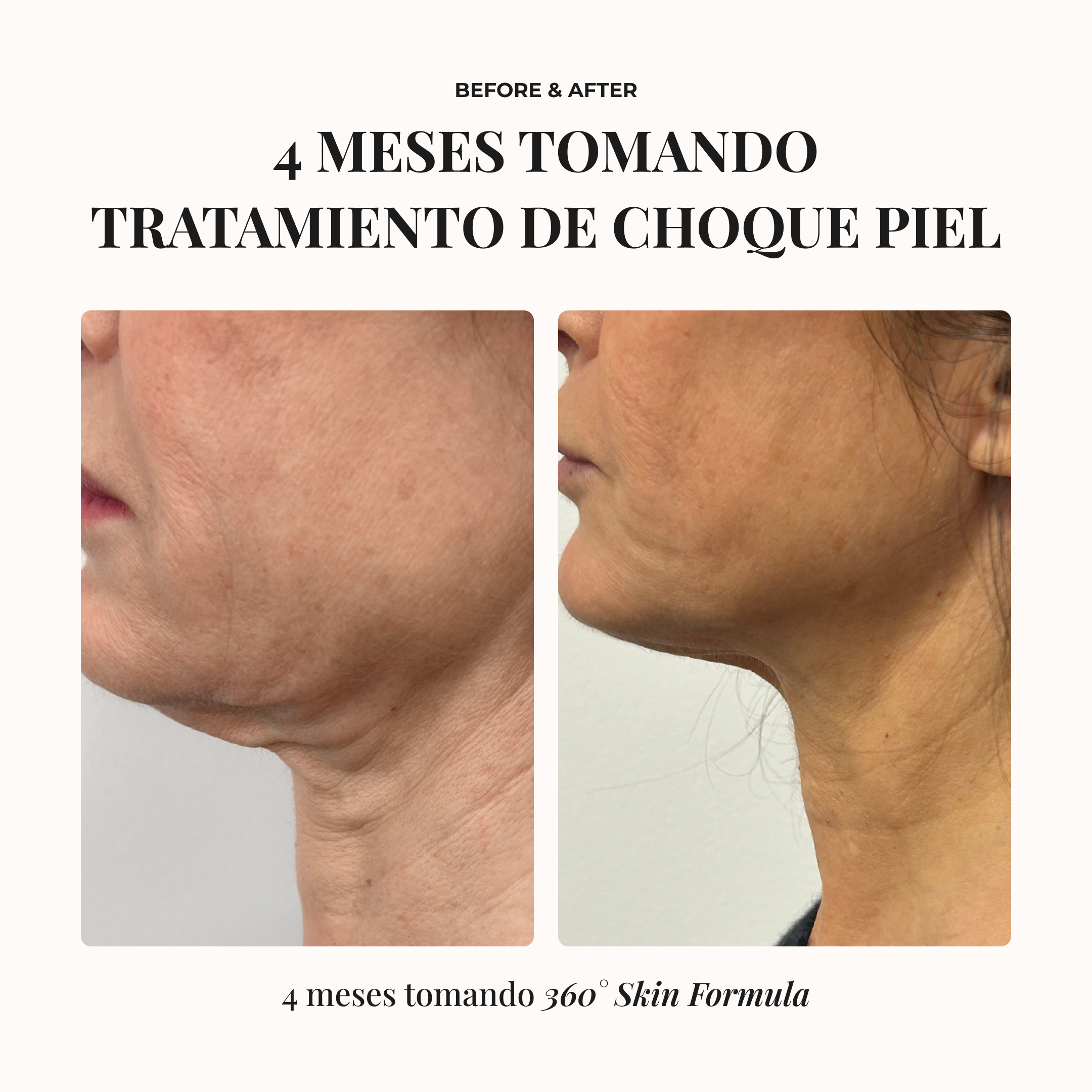 VIALES 360º SKIN FORMULA